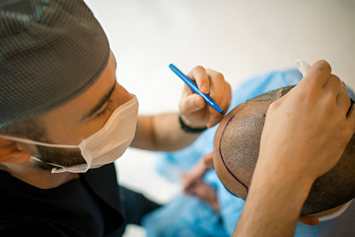 Advance Diploma in Trichology